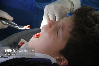  الهی‌راد: ۷ میلیارد تومان خدمات دندان‌پزشکی در خراسان شمالی ارائه شد