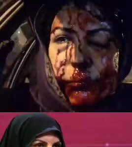 ببینید| شاهد عینی از ساچمه‌زنی به صورت: می‌خواست مرا بکشد