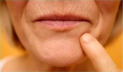  چرا لب‌ها با بالا رفتن سن نازک می‌شوند؟