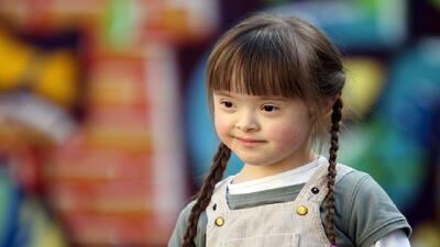  دعوت از خانواده‌ها برای عضویت در دبیرخانه کشوری اوتیسم