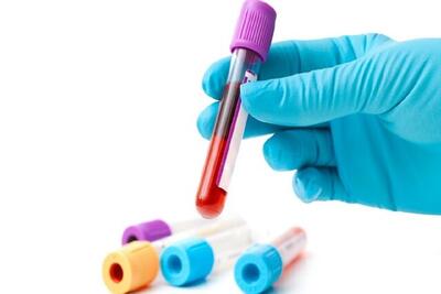  گفت و گو با مردی که خونش در ایران کمیاب‌تر از الماس است