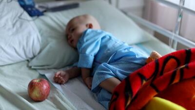  شایع‌ترین سرطان‌های کودکان در ایران