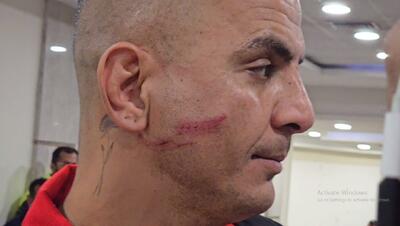  ببینید | برخورد شدید حامد لک با بازیکن ذوب آهن؛ شبیه اسکار فیس شدم!